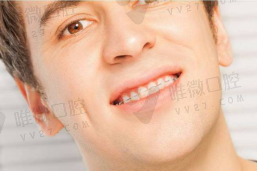 美牙仪对烤瓷牙有用吗（牙齿瓷贴面能用美牙仪吗）(图1)